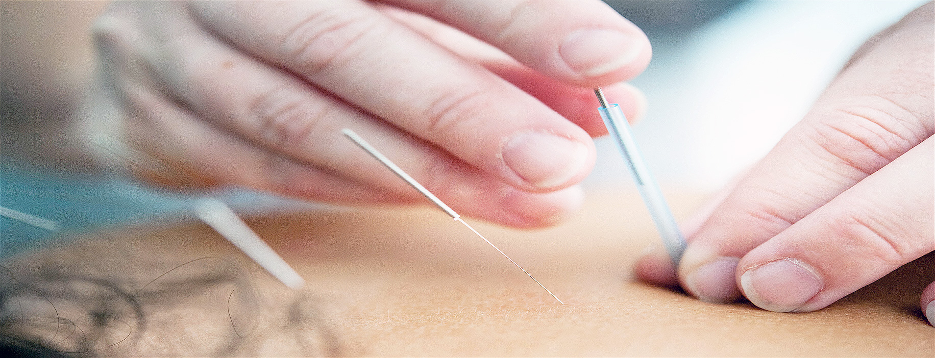 Acupuncture header